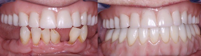 Marilyn - Williams Dentistry in Asheboro