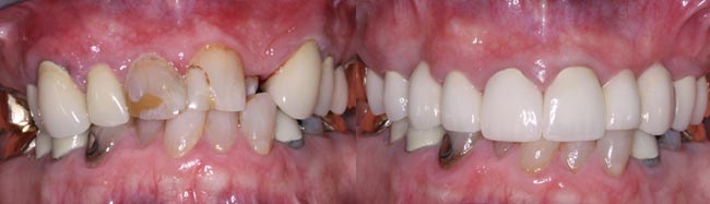 Max - Williams Dentistry in Asheboro