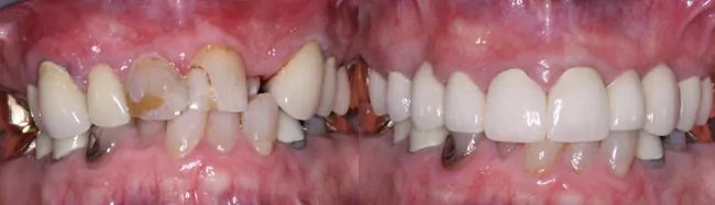 Max - Williams Dentistry in Asheboro